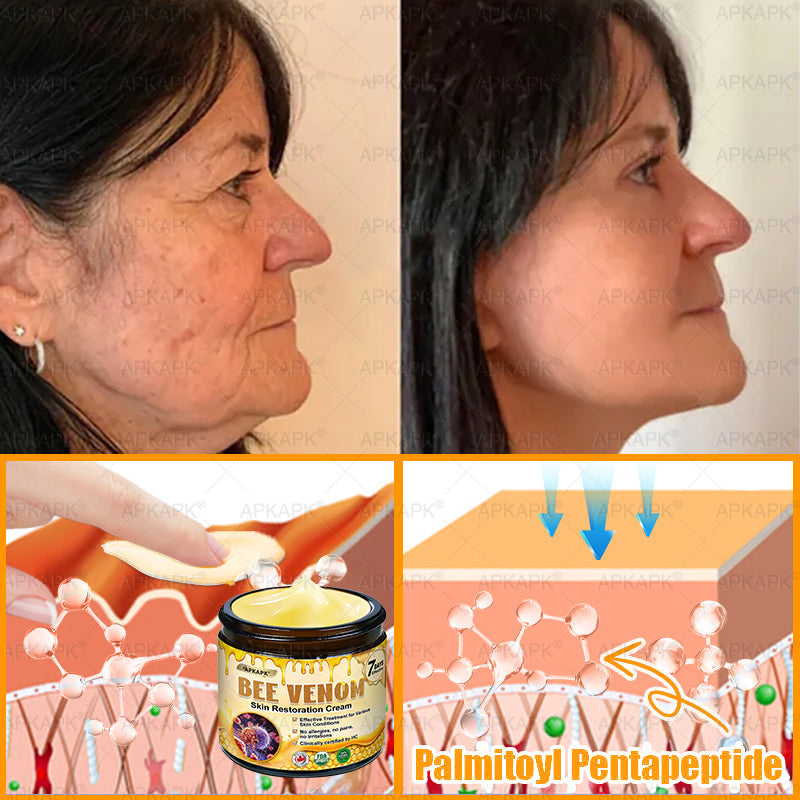 APKAPK®--Only 10 jars! Grab an exclusive 30% discount now! Keep your skin youthful and glowing in just 1 to 3 weeks. Don’t miss your chance—this offer won’t come around again until next year. Act fast! 180-day money back guarantee!